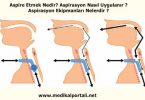 aspire-etmek-nedir-aspirasyon-nasil-uygulanir-aspirasyon-ekipmanlari-nelerdir