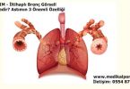 astim-bronsit-nedir-neden-olur-nedenleri-belirtileri-nelerdir-nasil-tedavi-edilir