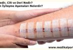 yara-nedir-dokusu-irrigasyonu-enfeksiyonu-bakimi-acilmasi-asamalari-cesitleri-nelerdir