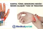 karpal-tunel-sendromu-nedir-meslek-hastaligi-belirtileri-nelerdir-neden-olusur-tedavisi-el-bilek-hastaligi